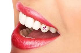 DentalJewellary